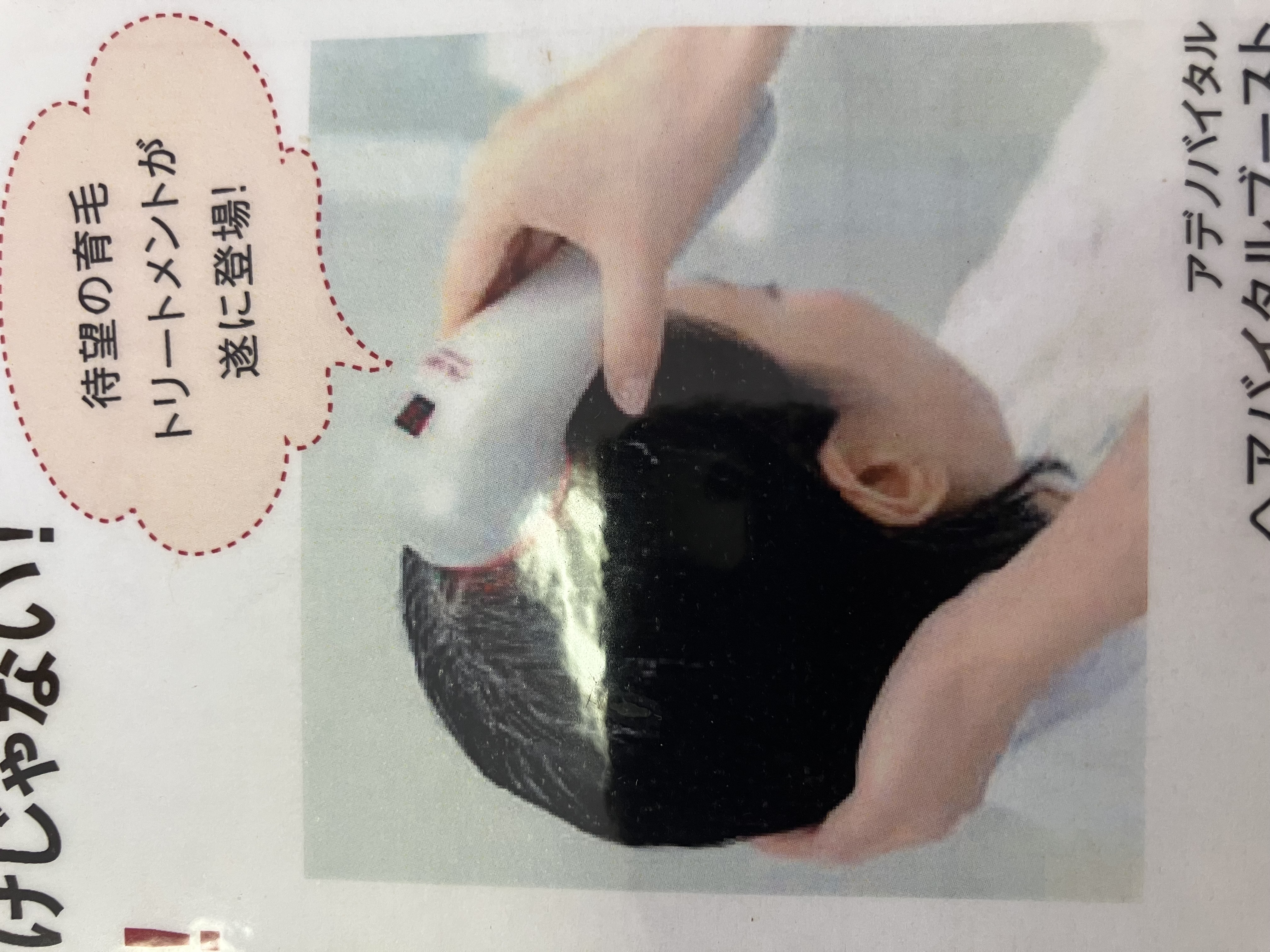 育毛スパで抜け毛予防しませんか？